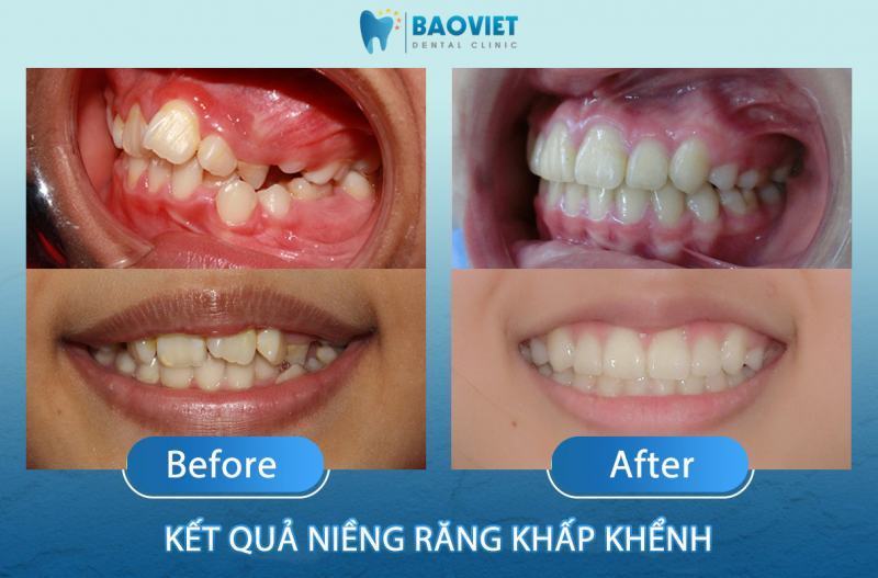 Bao Viet Dental Clinic