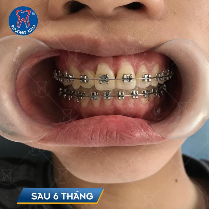 Phuong Nam Dental Clinic