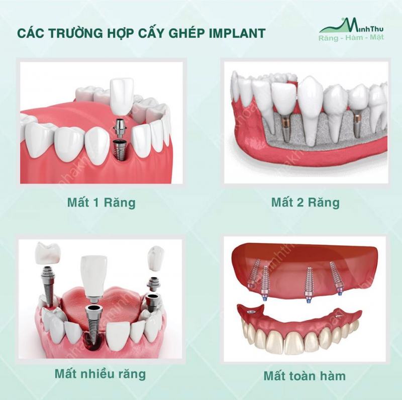 Minh Thu Dental Clinic