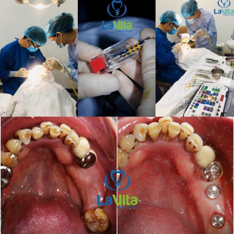 LaVita Dental Clinic