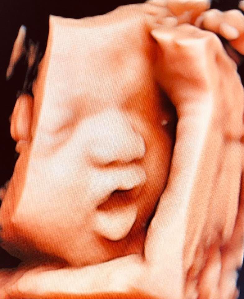 34 weeks fetus pictures