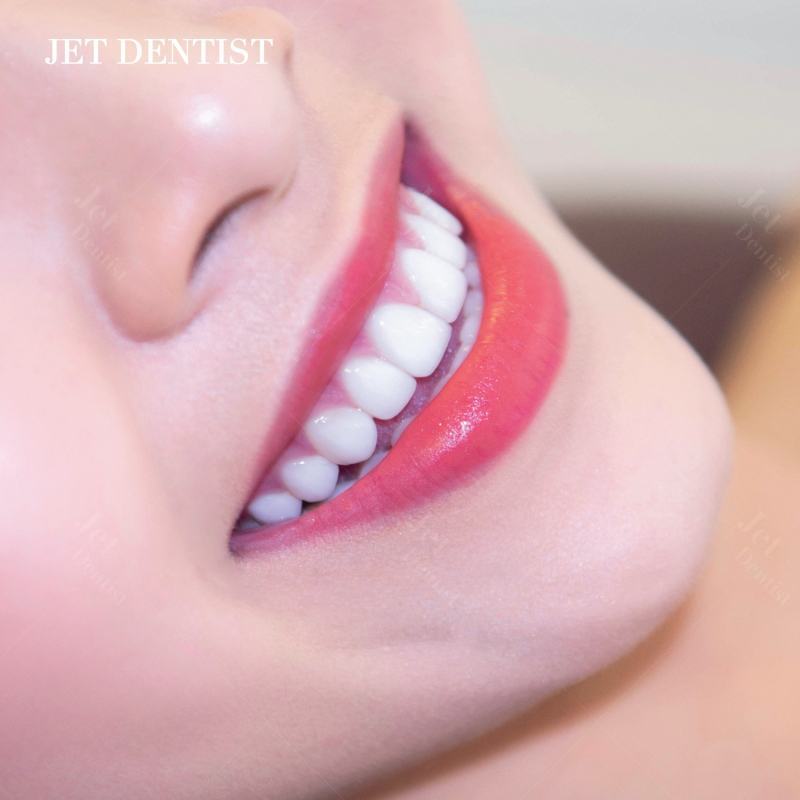 Jet Dentist International - Jet Dentist