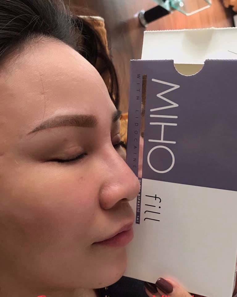 Miho Ultra Injectable Filler
