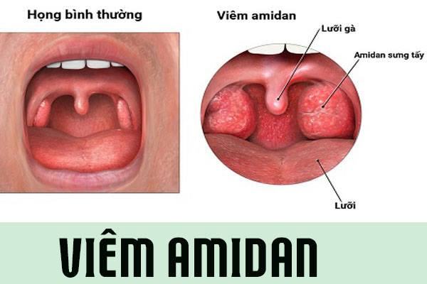 Ear, Nose Throat Clinic in Phu Khe Commune