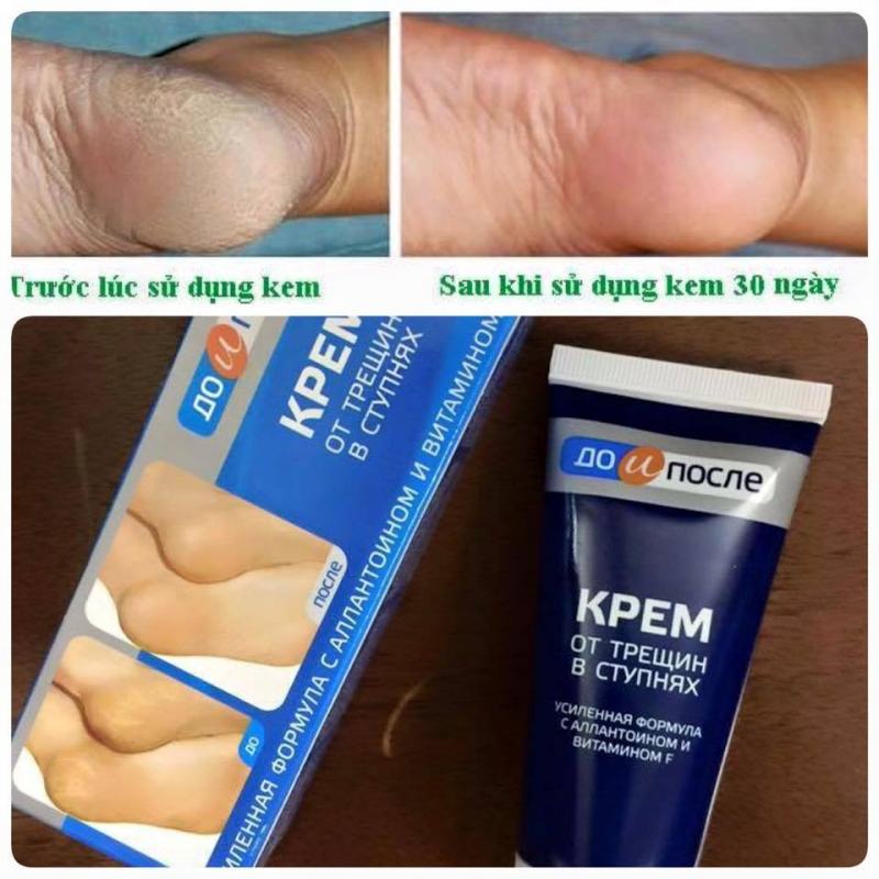 Kpem Apteka Cracked Heel Cream