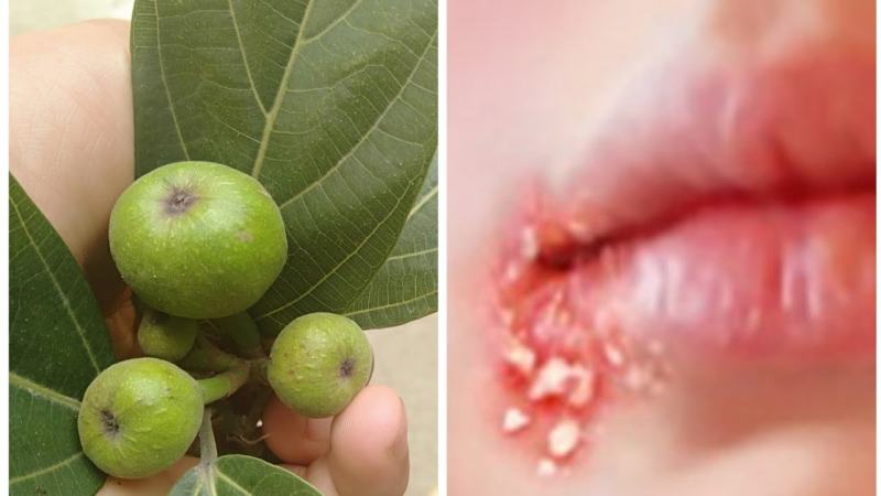 Fig leaves have good antiseptic and anti-inflammatory properties and have been used since ancient times in the treatment of shingles, anti-inflammatory.