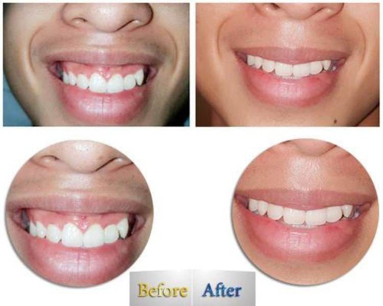 Customers before and after treatment at BSSKIN