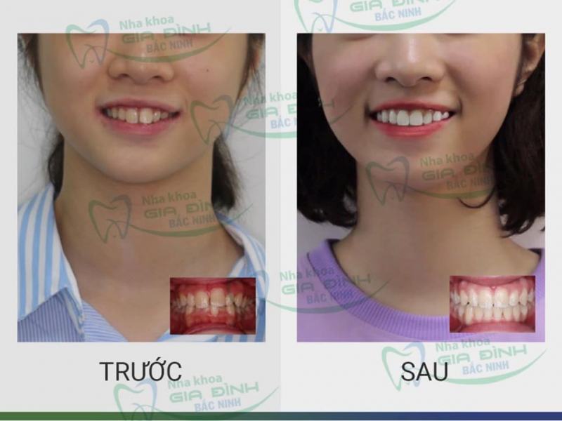 Bac Ninh Family Dental Clinic