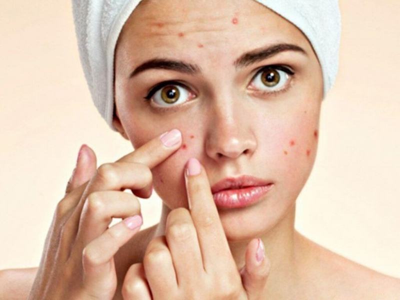 After washing your face, do not use a towel to dry it