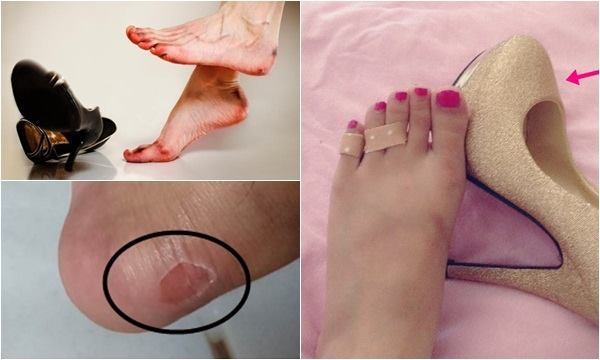 Don't try to wear shoes that are too tight, you won't know how bad the consequences will be