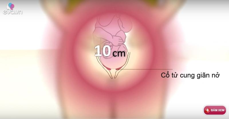 When the cervix is ​​dilated 10 centimeters, the baby is ready to be born
