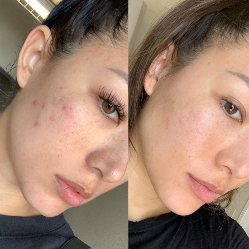 Before and After Using SkinCeuticals Daily Moisture