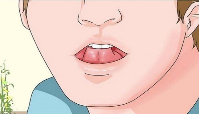 Touch the tip of your tongue to the roof of your mouth to relieve headaches