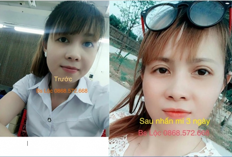 Beauty Miss Duyen Quy Nhon