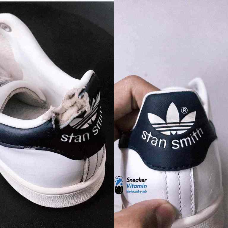Perfectly patch your shoes at Sneaker Vitamin