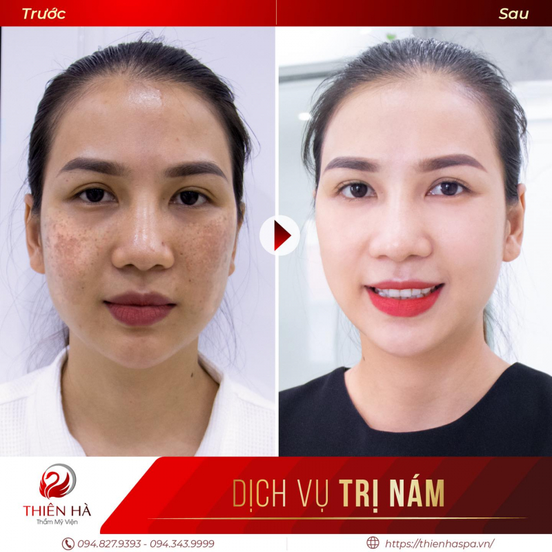 Thien Ha Beauty Institute