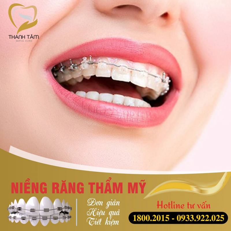 Braces at Thanh Tam Dental Clinic