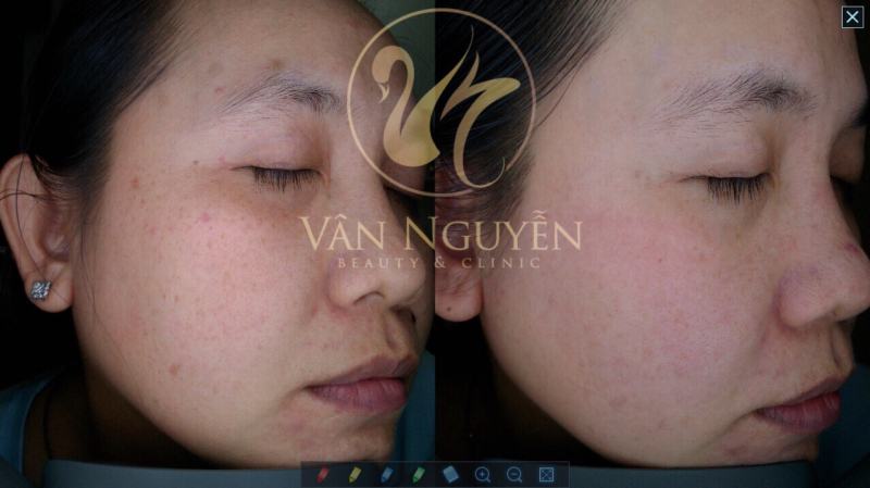 Van Nguyen Spa & Clinic