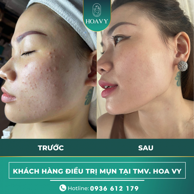 Hoa Vy Spa Beauty Salon