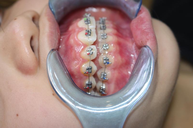 Bao Ngan Dental Clinic
