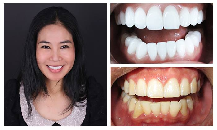 Thanh Tu Cosmetic Dentistry