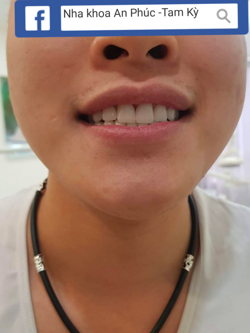 An Phuc Cosmetic Dentistry