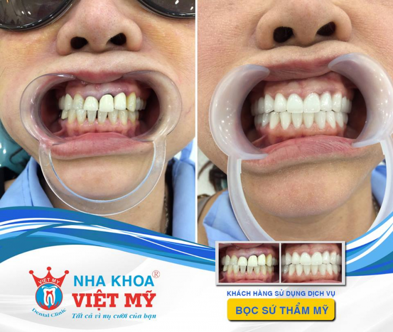 Viet My Dental Clinic - Tam Ky