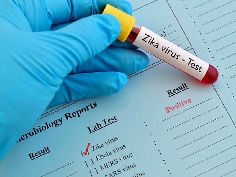 Testing for Zika virus disease