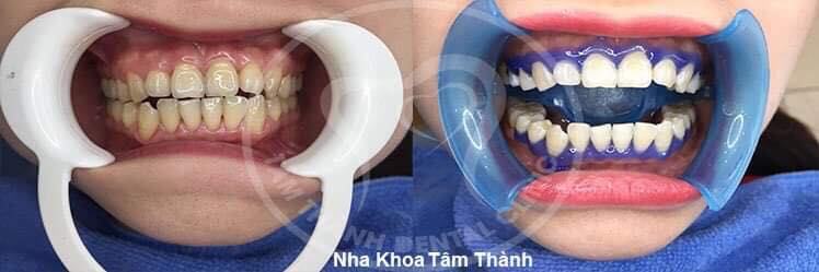 Tam Thanh Dental Clinic Tuyen Quang